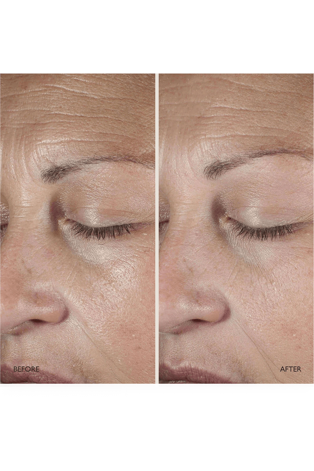 תמונת פנים של Queen Serum 30 ml