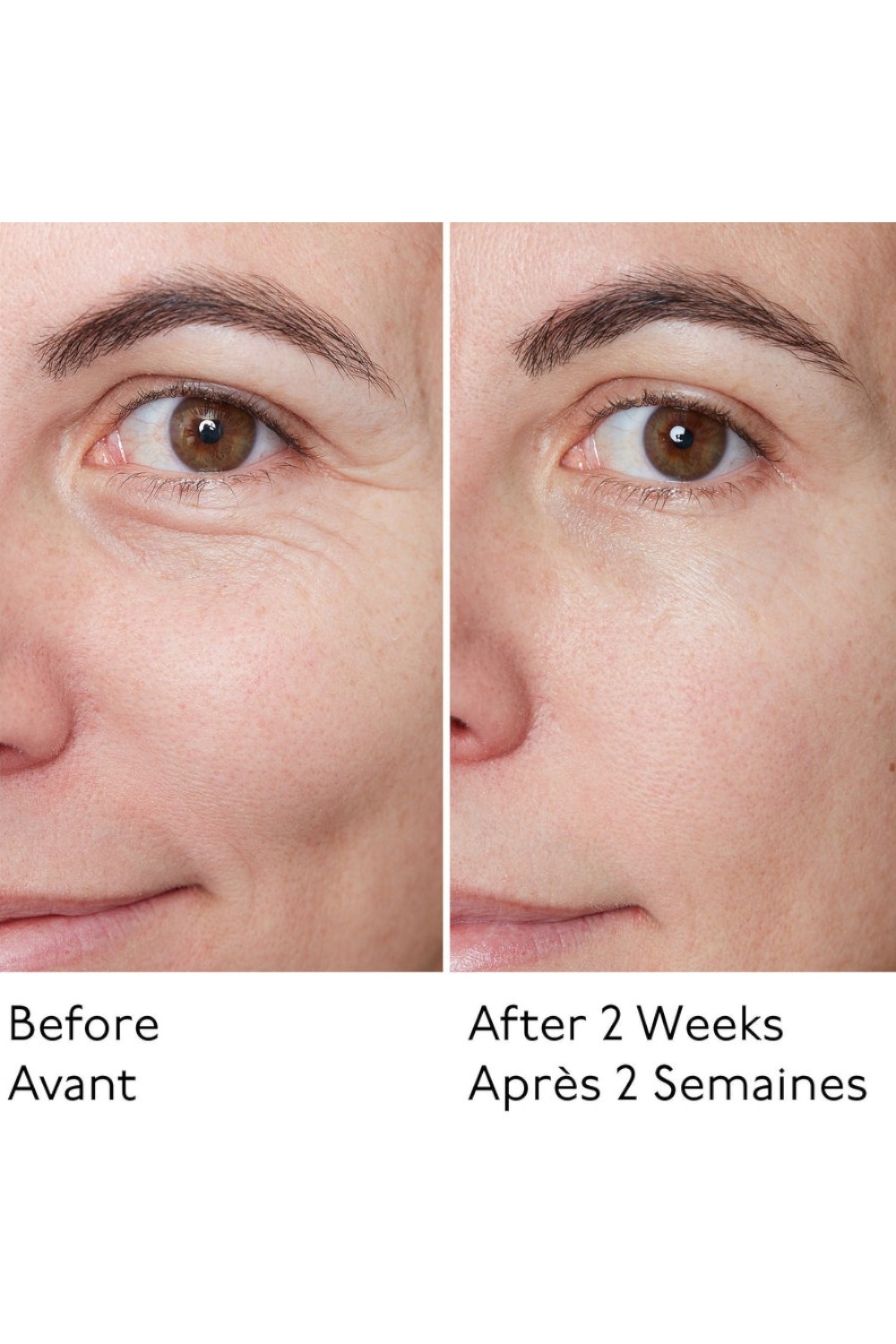 תמונת פנים של Hyaluronic Global Serum 30ML